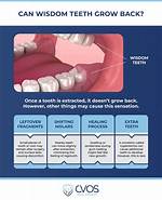 When Wisdom Teeth Grow?