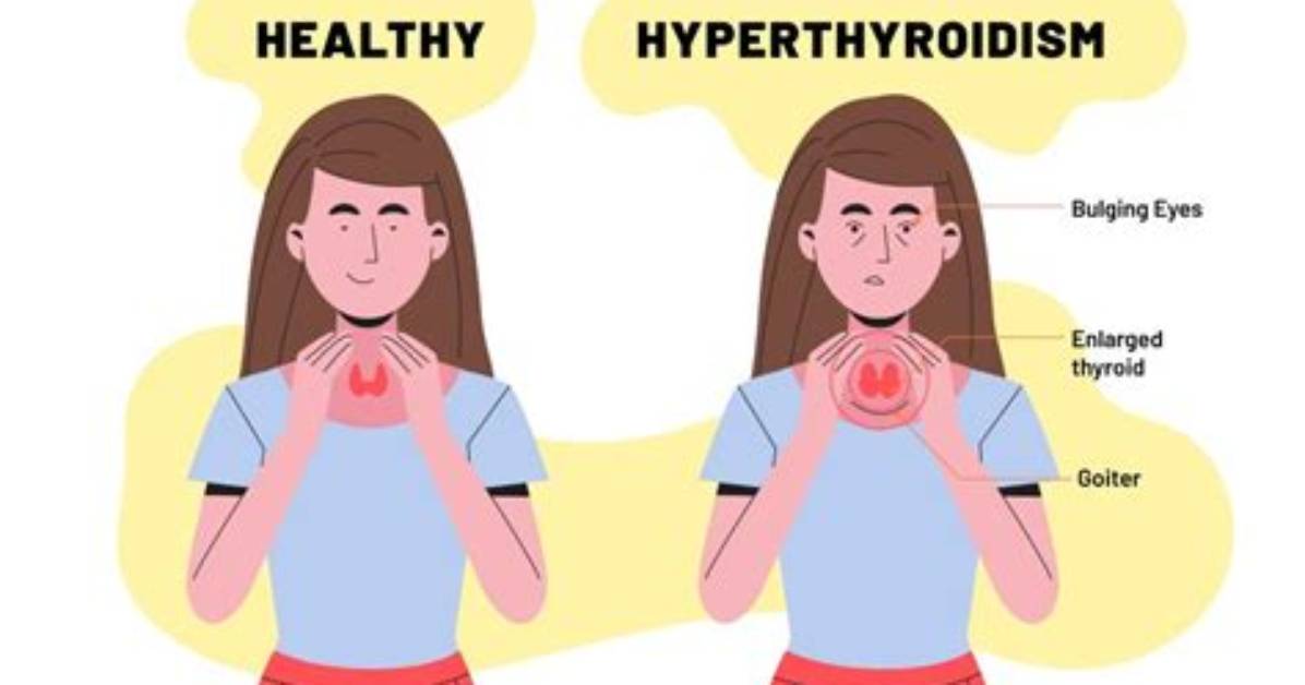 When Your Thyroids Are High?