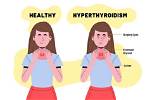 When Your Thyroids Are High?