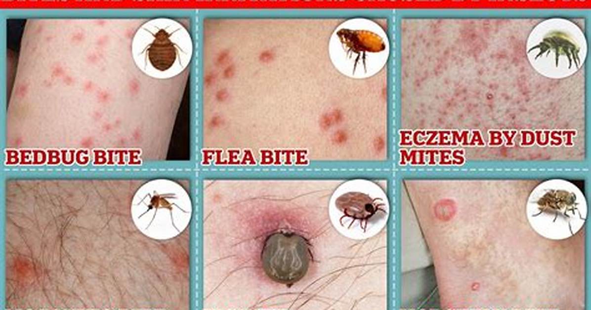 Where Do Bed Bugs Bite?