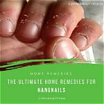 Where Do Hangnails Grow?