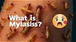 Where Do Myiasis Live?