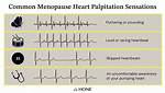 Where Do Palpitations Occur?