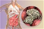 Where Do Pinworms Live