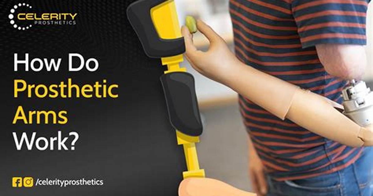 Where Do Prosthetics Work?