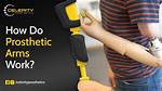 Where Do Prosthetics Work?
