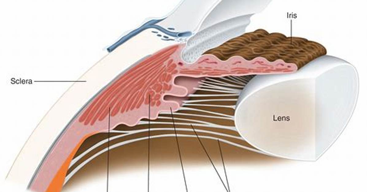 Where Do Zonules Attach to Lens?