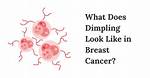 Where Does Breast Dimpling Occur?