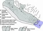 Where Does Crevasse Form?