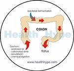 Where Does Flatus Occur?