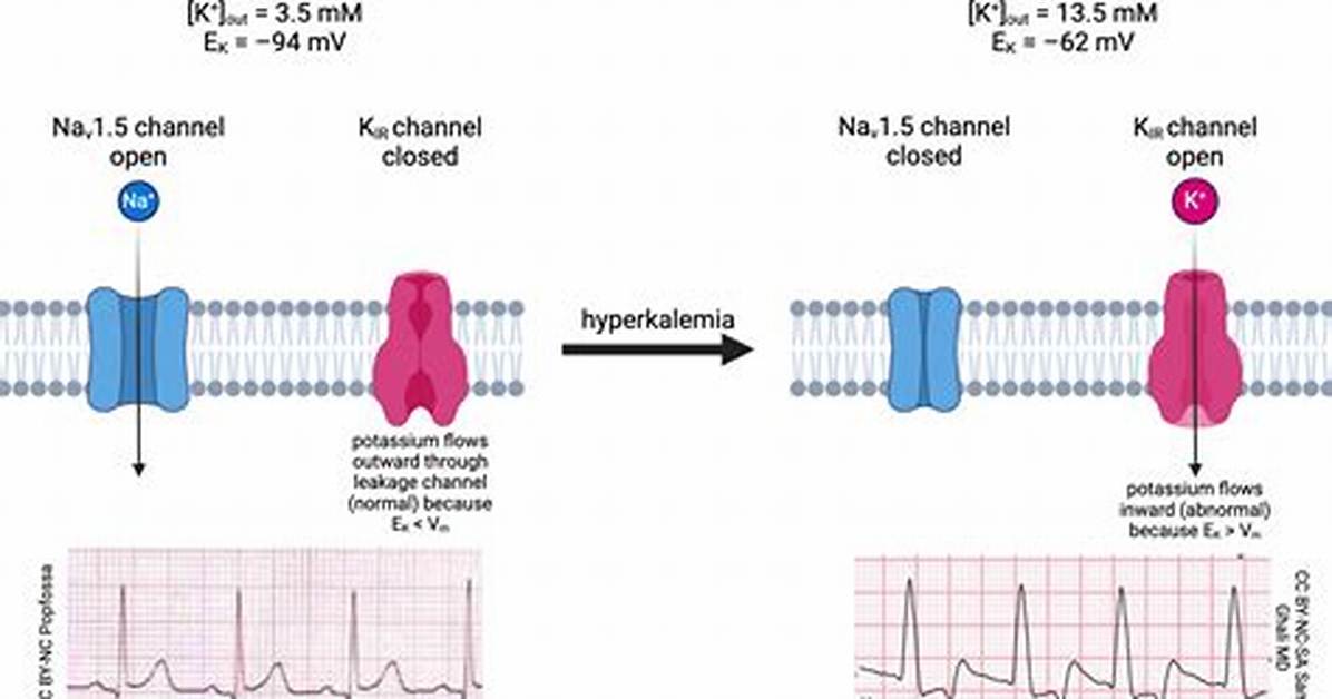 Where Does Hyperkalemia Affect?