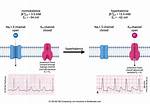 Where Does Hyperkalemia Affect?