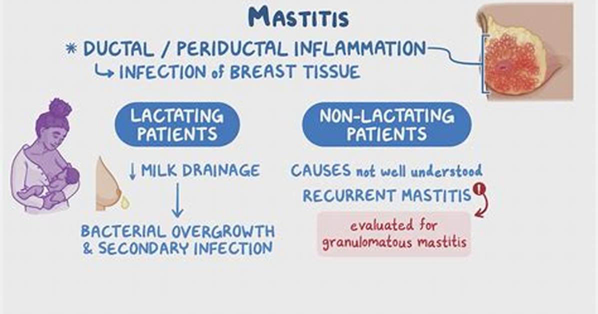 Where Does Mastitis Occur?