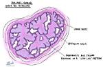 Where Does Phyllodes Come from?