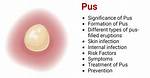 Where Does Pus Come from?