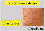 Where Does Rubella Infect