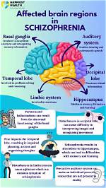 Where Does Schizophrenia Affect?