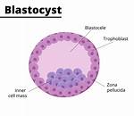 Where Does the Blastoid Live?