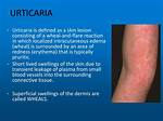 Where Does Urticaria Start?