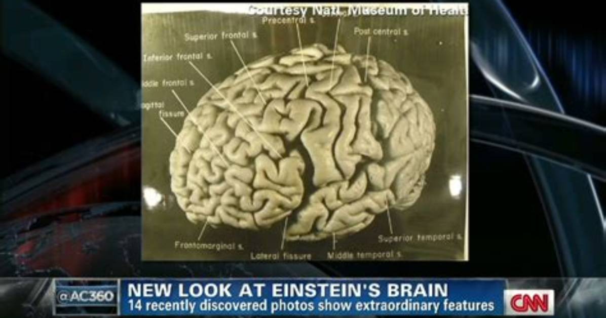 Where Is Albert Einstein Brain?