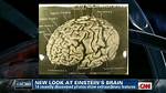 Where Is Albert Einstein Brain?