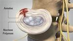 Where Is Annulus Found?