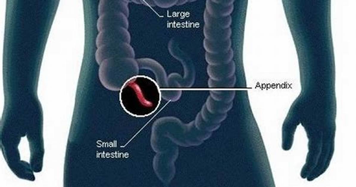 Where Is Appendix Located