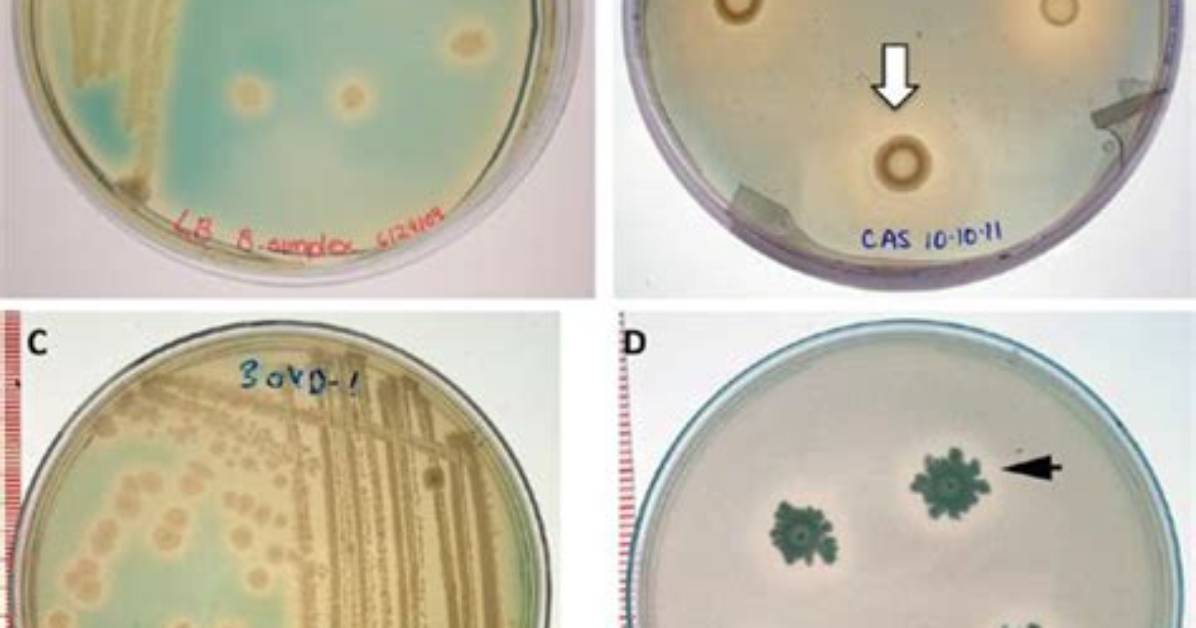 Where Is Bacillus Simplex Found?
