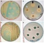 Where Is Bacillus Simplex Found?