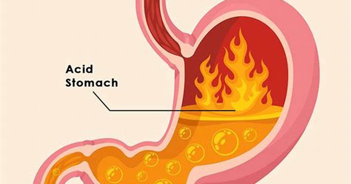 Where Is Hyperacidity Found?