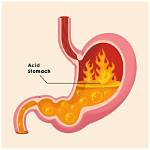 Where Is Hyperacidity Found?