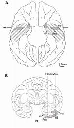 Where Is the Rhinal Cortex?
