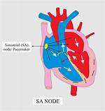 Where Is the Sa Node Located