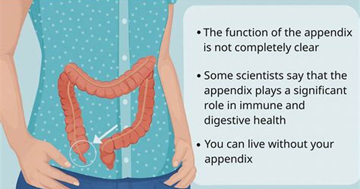 Where Is Your Appendix?