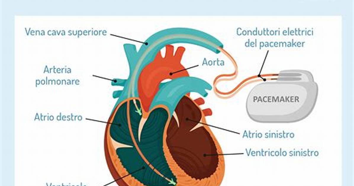 Where Pacemaker Come from?