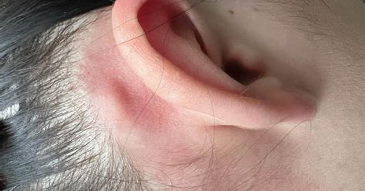 Which Behind the Ear?