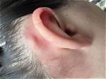 Which Behind the Ear?