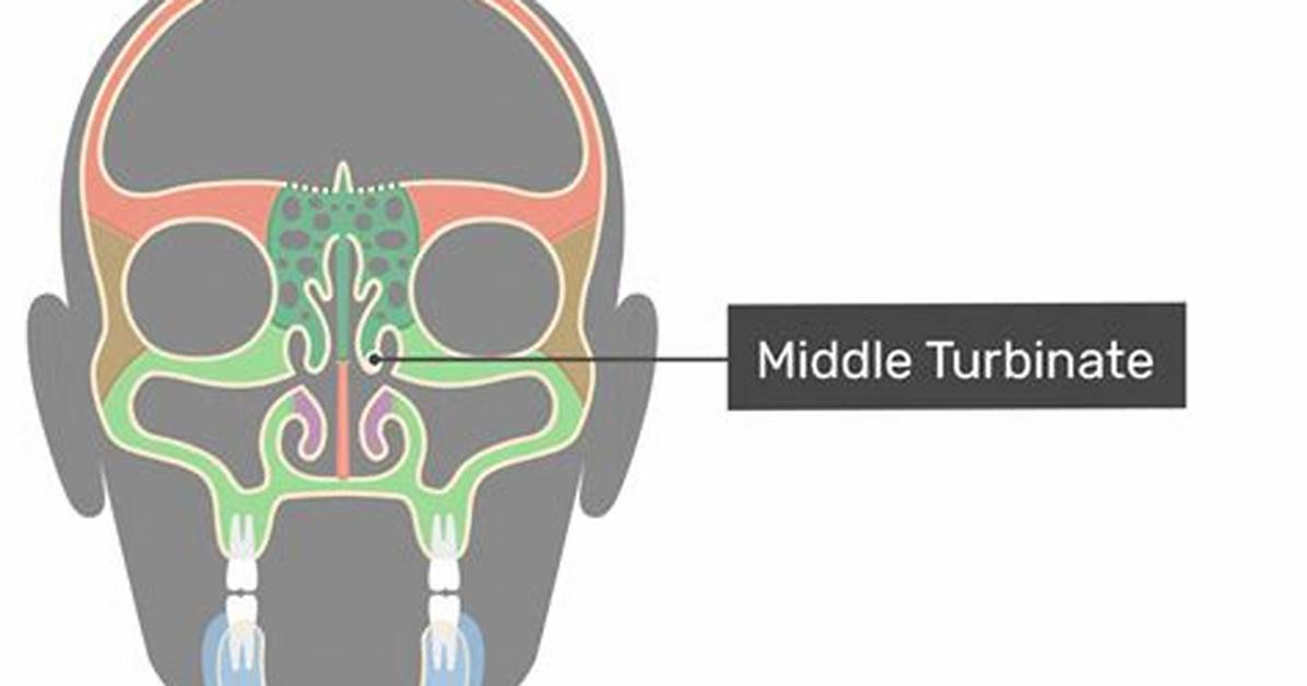 Which Bone Forms Turbinate?