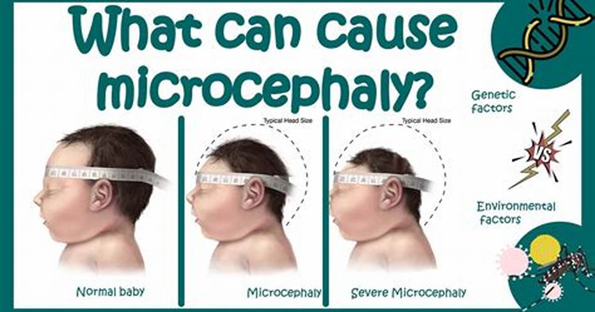 Which Can Cause Microcephaly?