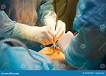 Which Doctor Performs Laparoscopy?