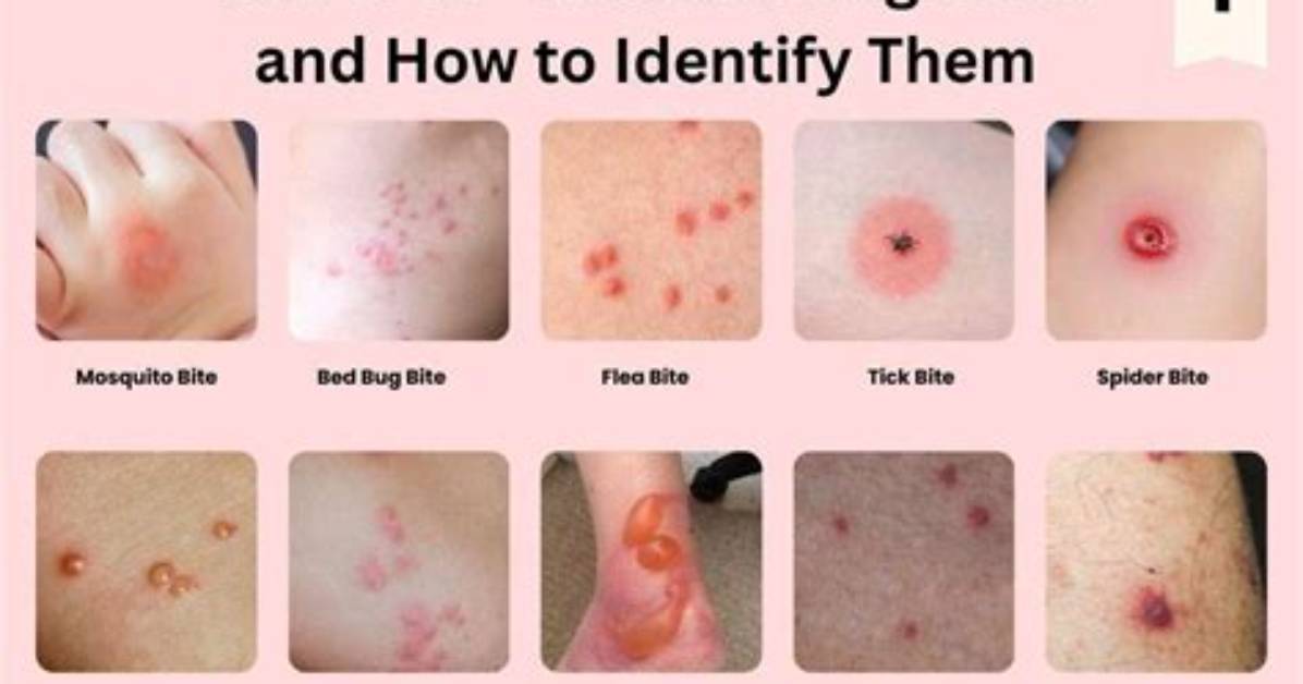 Which Insect Can Bite?