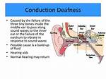 Which Is Conduction Deafness?