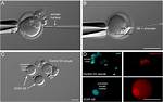 Which Is Enucleated Cell?