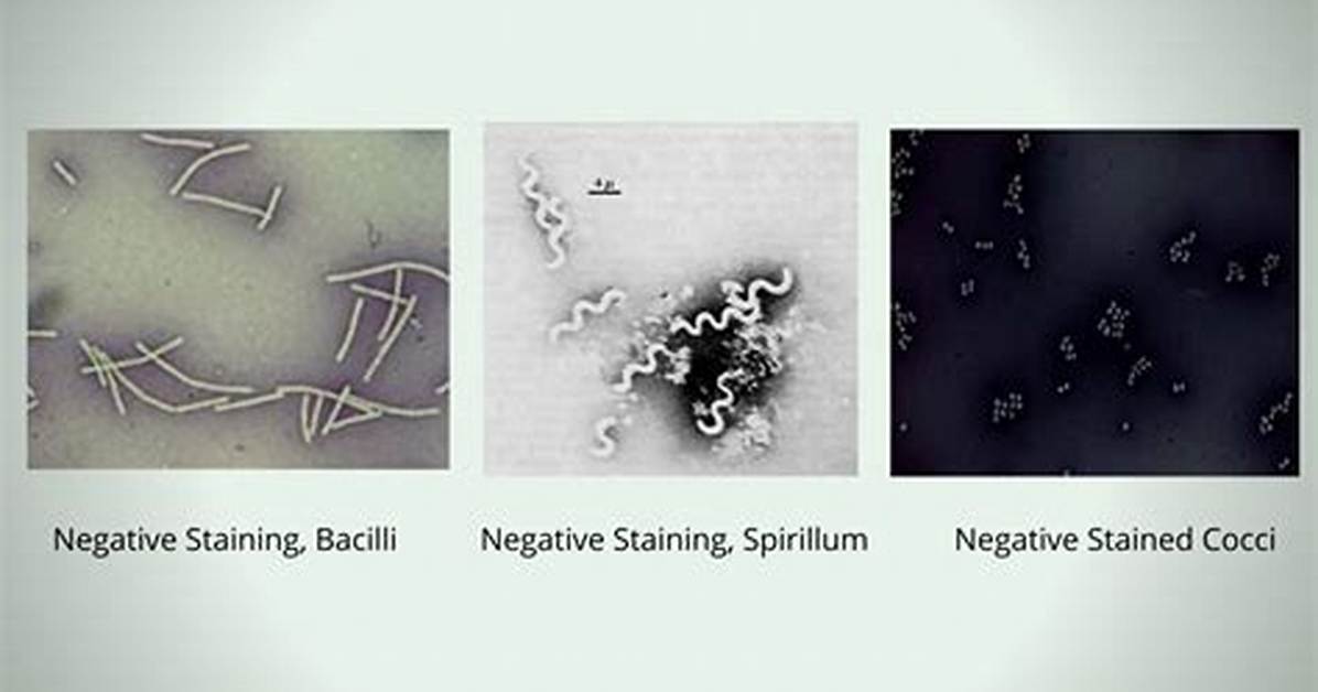 Which Is Negative Staining?