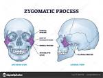 Which Is the Zygomatic Process?