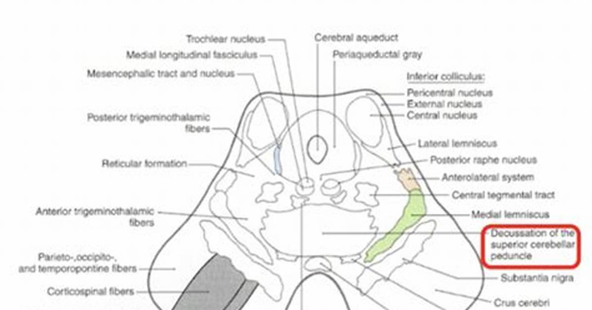 Which Midbrain Structures Mediate Visual Reflexes?
