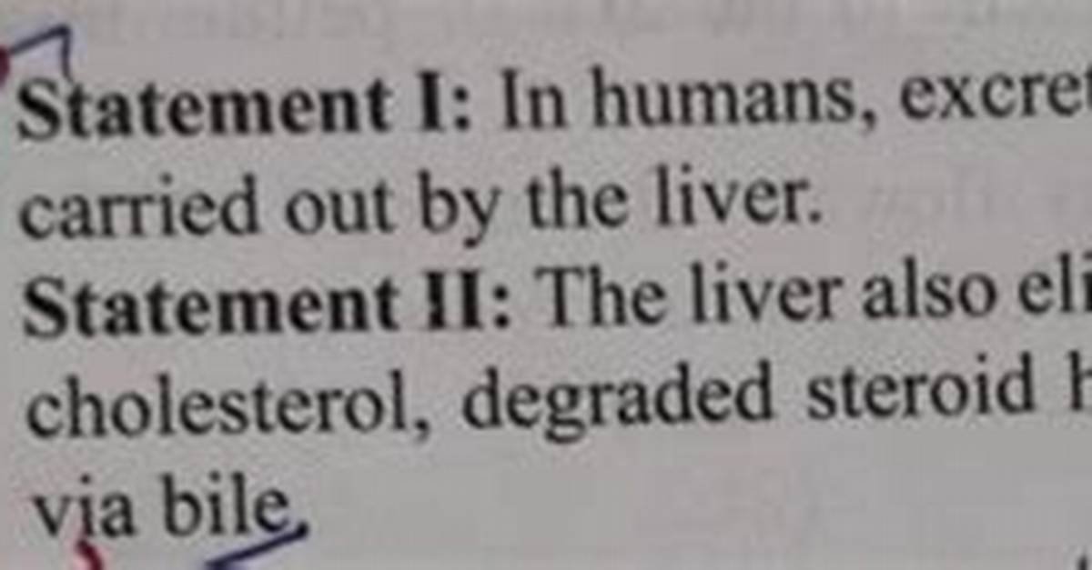 Which Statement Describes Excretion?