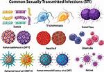 Which Std Is a Viral Std