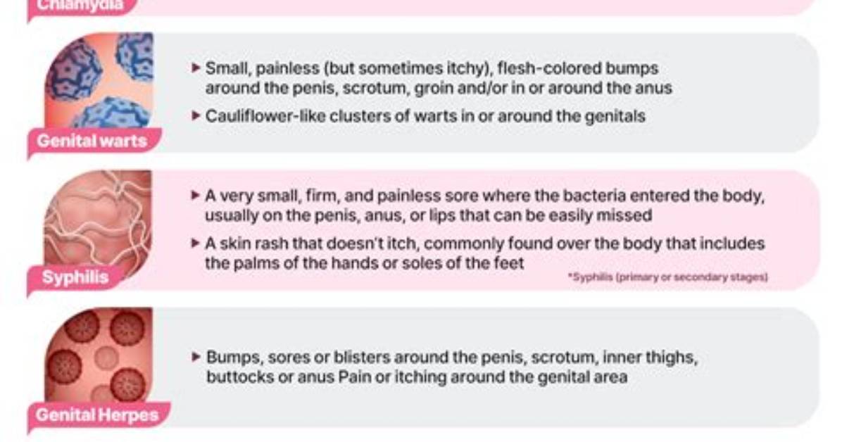 Which Std Makes You Itch?