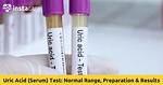 Which Test for Uric Acid?